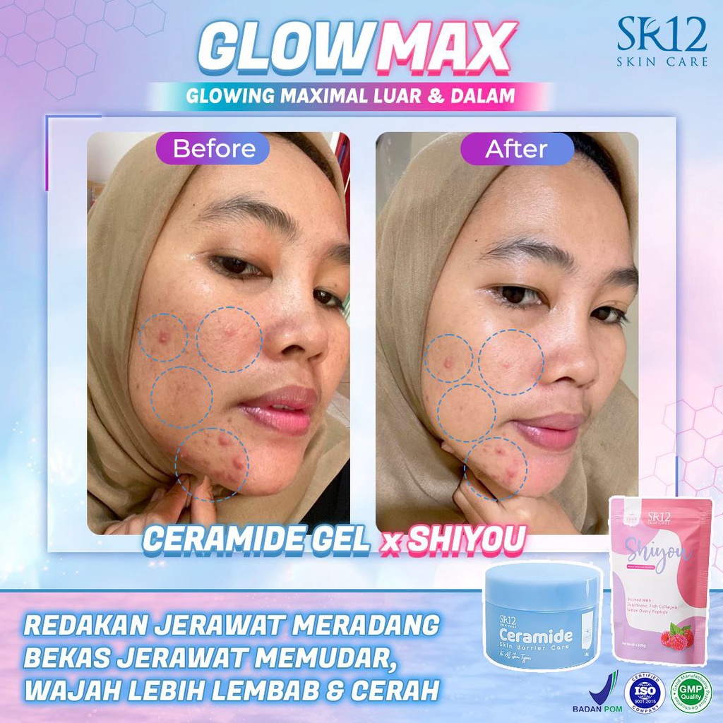 Ceramide Skin Barrier Care SR12 Moisturizer Cream Pelembab Wajah BPOM