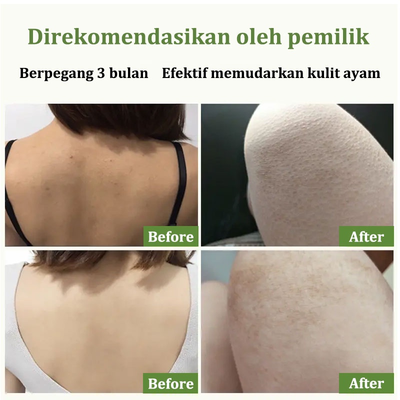 【Barang ready】scrub pengelupasan kulit  niacinamide scrub body dan butt eksfoliasi mengeksfoliasi lulur tubuh whitening scrub pemutih body pengelupasan kulit mati meningkatkan kulit halus pemutih kulit