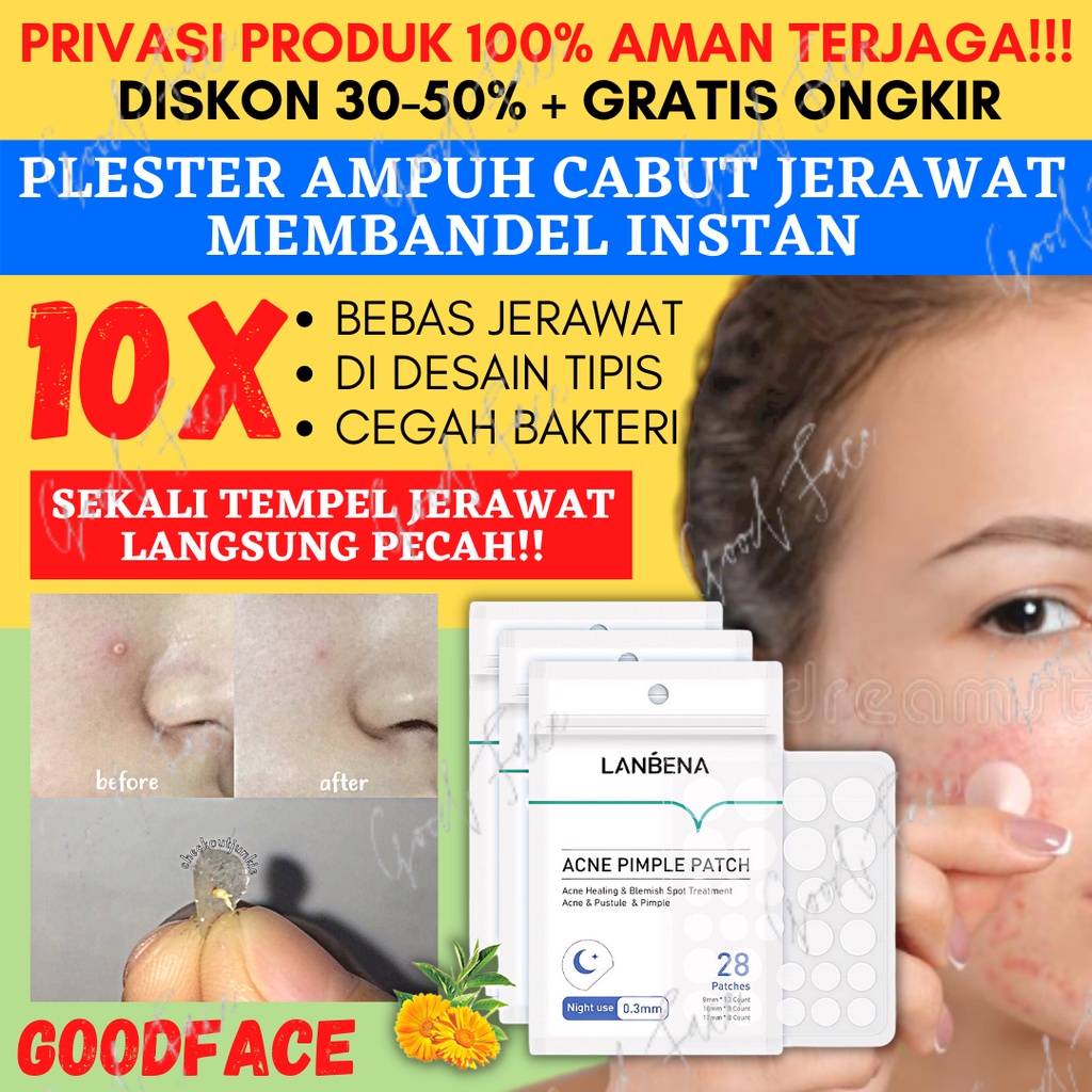 Jual LANBENA Acne Pimple Patch Topeng Wajah -Sticker Jerawat Day ...