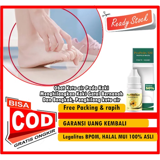 Obat Kutu air Pada Kaki, Menghilangkan Kaki Gatal Bernanah Dan Bengkak, Penghilang kutu air, Gatal k