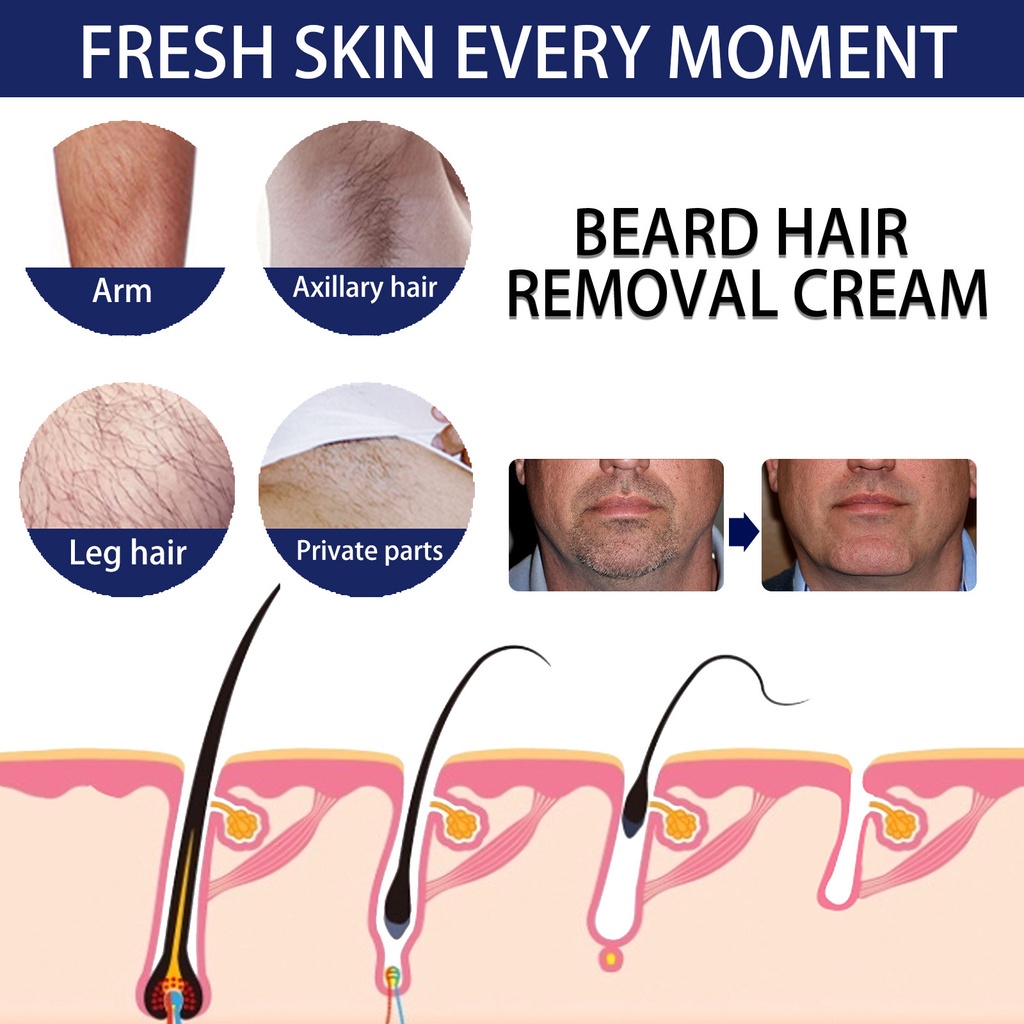 Krim Penghilang Bulu Pria Brewok Permanen Hair Removal Perontok bulu Kumis area wajah Cepat Tanpa Efek Samping