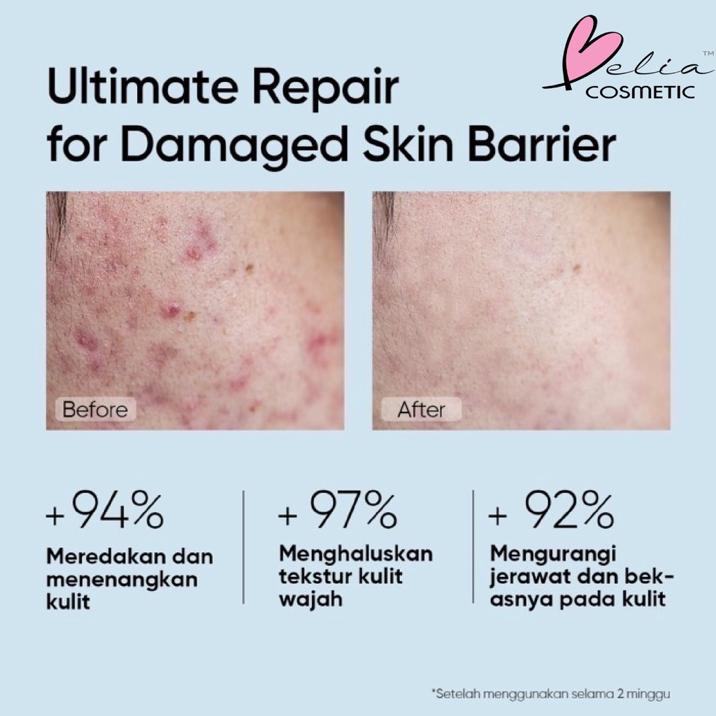 ❤ BELIA ❤ SKINTIFIC 5X Ceramide Series | Moisturzer | Cleanser | Soothing Toner | Serum Sunscreen | Repairing Mask | Repair Serum | BPOM