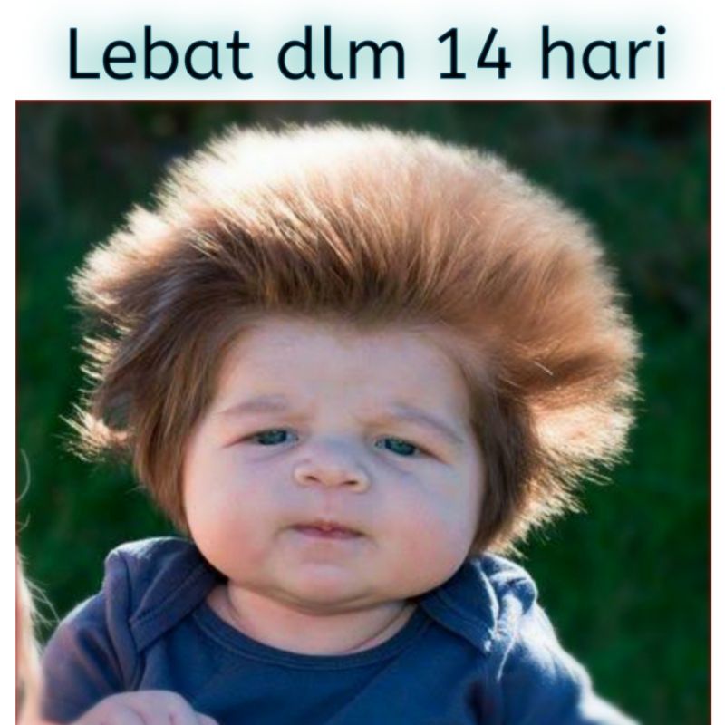 Tester Minyak Penumbuh Rambut Bayi Baby Hair Growth Black Valen