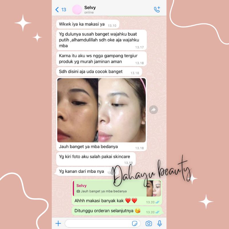 THERASKIN PAKET HEMAT NORMAL GLOWING CRYSTAL