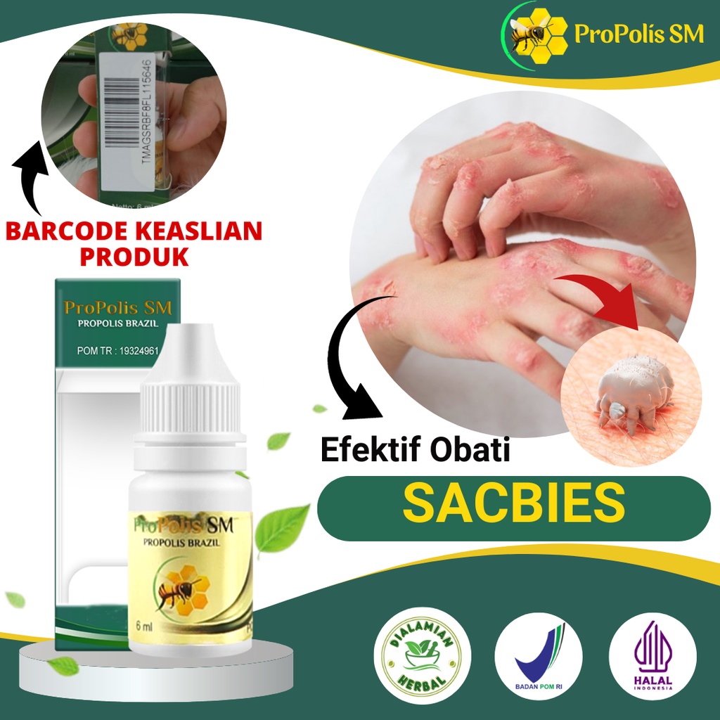 Obat Scabies Manusia Kudis Budug Bernanah Propolis SM Original