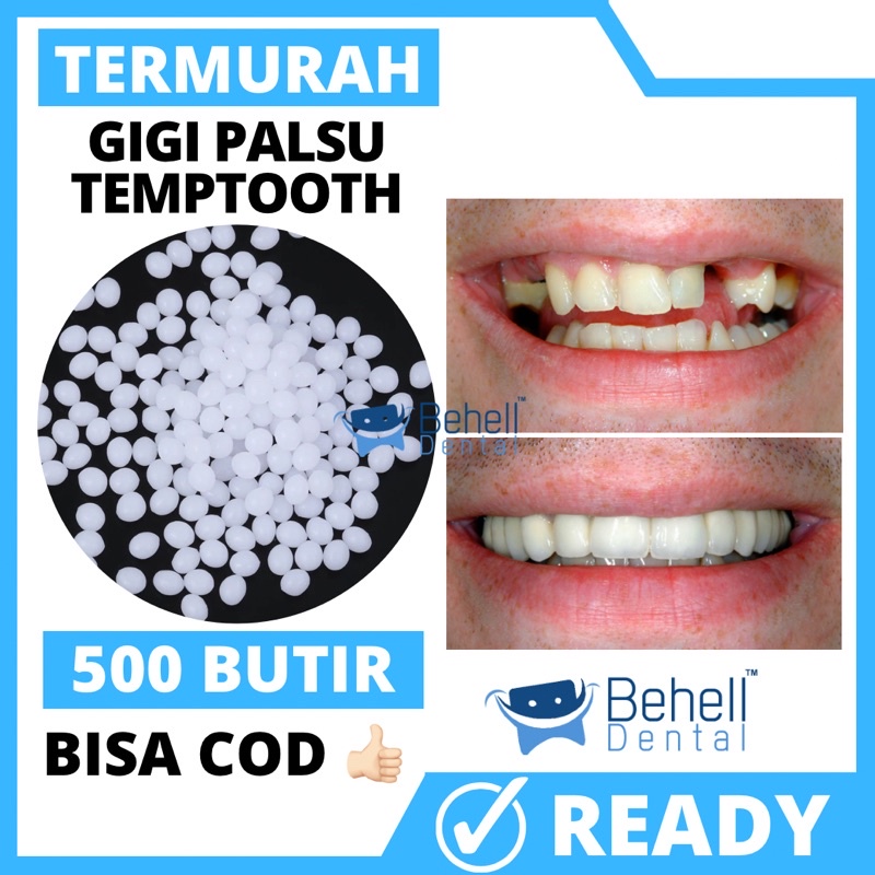 TERMURAH !! 500 BUTIR TEMPTOOTH GIGI PALSU SEMENTARA PENAMBAL GIGI PATAH RENGGANG / TEMTOOTH / BAHAN TAMBAL GIGI BOLONG BERLUBANG / TEMPORARY TOOTH INSTAN PRAKTIS / TEMPTOOTH GINGSUL PATAH LEM TIRUAN MURAH ORIGINAL ISI 200 / 500 / 400 / 150 / 100 BUTIRi