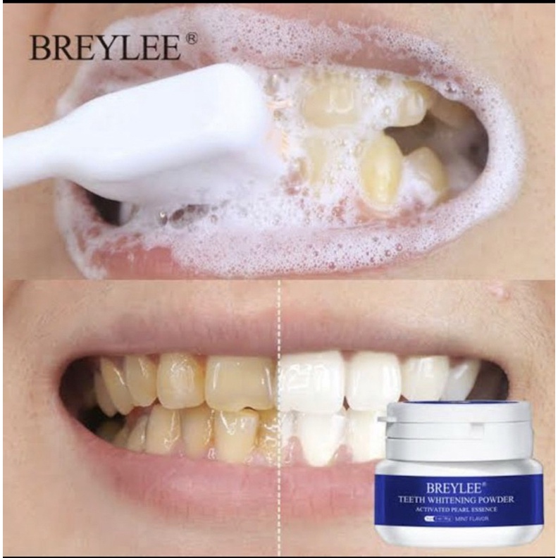 Breylee Teeth Whitening Powder 100% original Pemutih gigi
