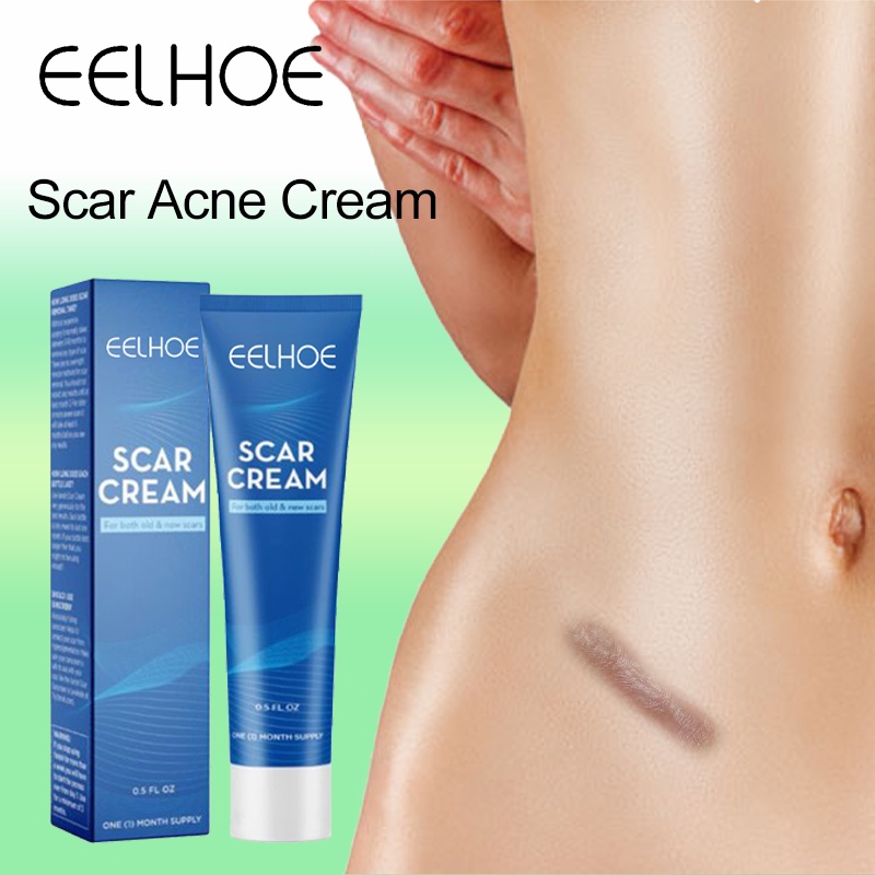 Eelhoe Scar Cream Penghilang Bekas Luka / Keloid Anti Scar Stretchmark 30gr Scar Cream Removel