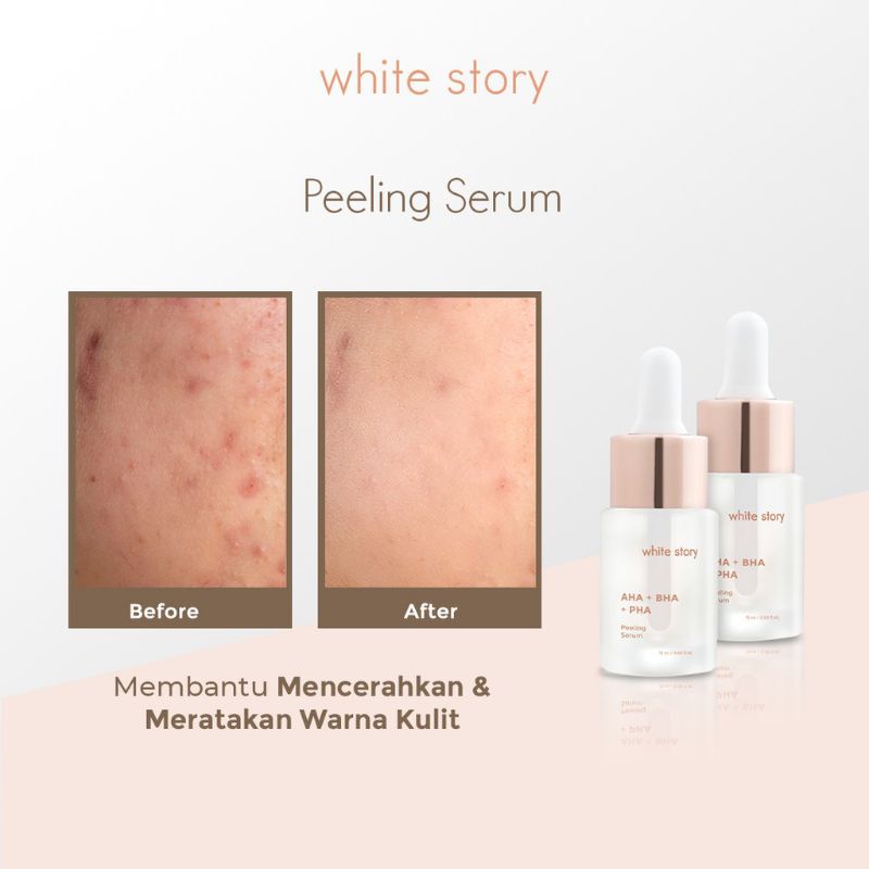 White Story Peeling Serum