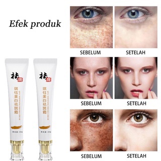 krim Serum cream Flek Hitam Cream Penghilang Cream flek Penghilang 50g Pemutih Asli Dan Penghilang Bintik Memudarkan Bintik Menghilangkan flek Cream penghilang