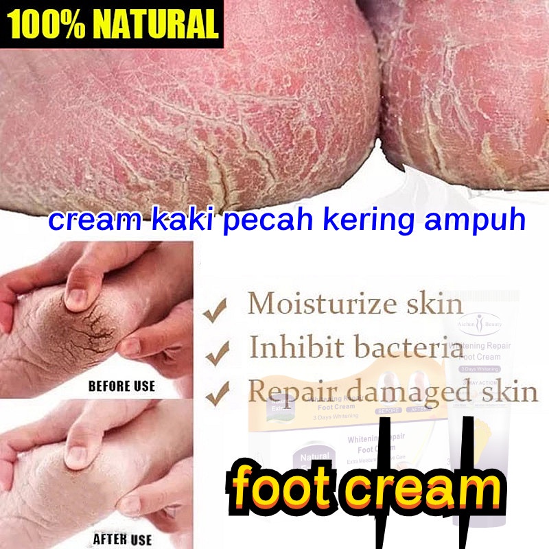 cream kaki pecah kering ampuh krim kaki pecah pecah Obat kaki pecah dan kering Tumitku obat kaki pec