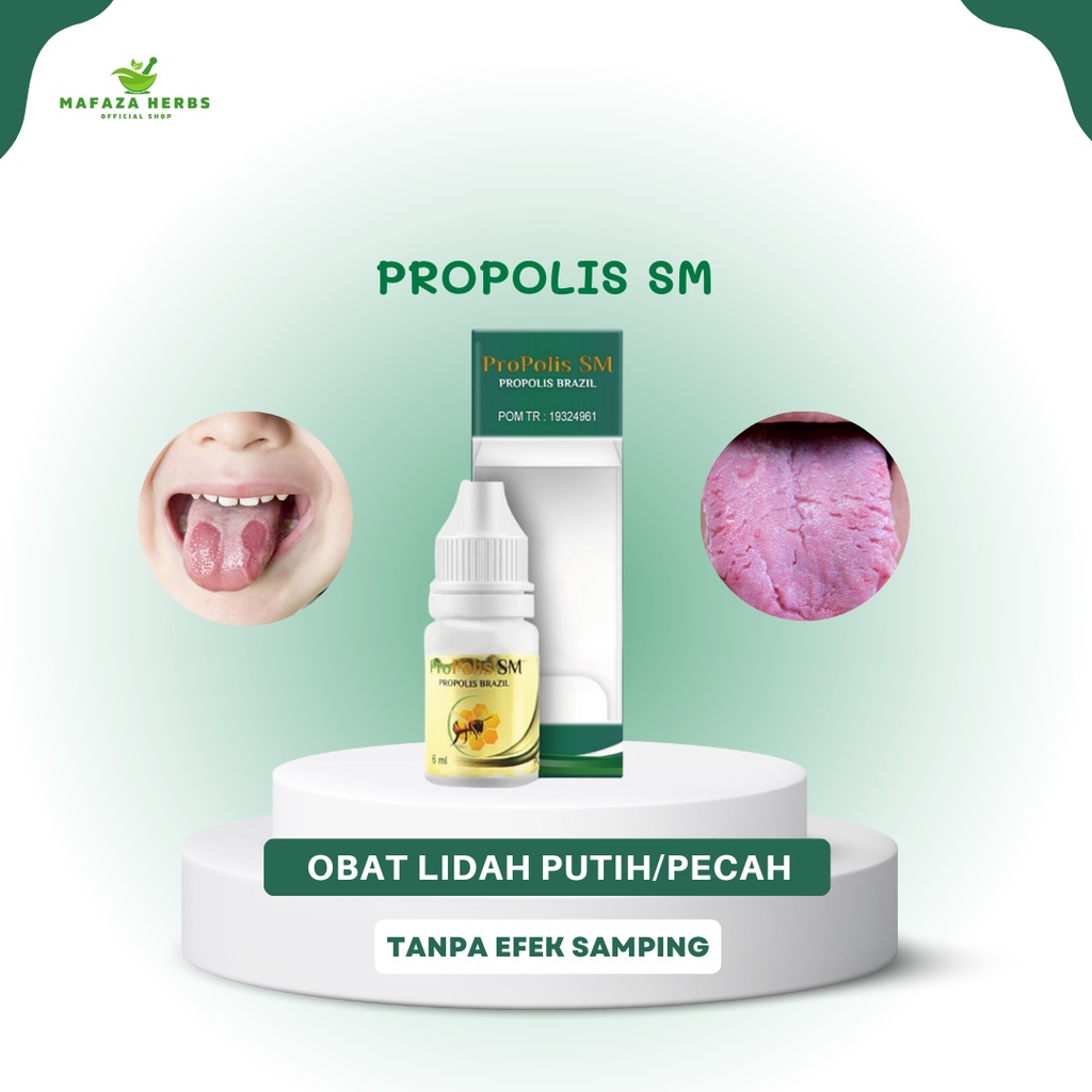 Jual Mafaza Herbs Obat Tetes Lidah Putih Lidah Berjamur Lidah