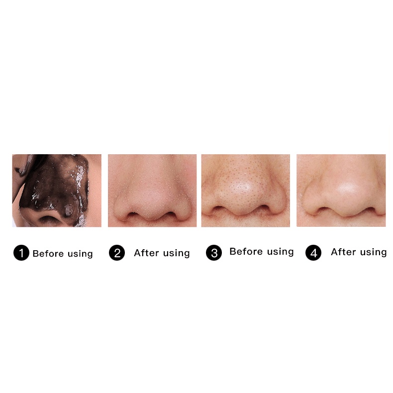 Perawatan Kecantikan Wajah Perawatan Kecantikan Wajah Hidung Masker Rias Penghilang Komedo Kepala Hitam Kepala Hitam Mengelupas Mineral Pembersih Pori Lumpur Pembersih Jerawat Hidung