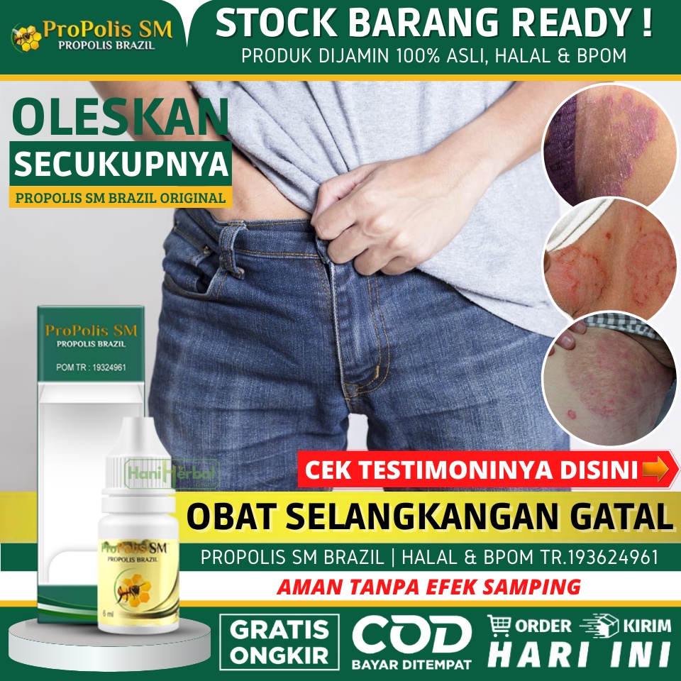 Jual Obat Untuk Gatal Gatal di Selangkangan 100 Alami Obat