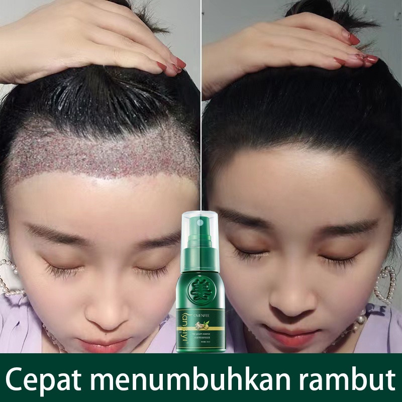 Serum Rambut Kering Serum Rambut Rontok Perawatan Rambut 30ml Semprotan Pertumbuhan Rambut Memelihara Akar Rambut Dan Memperbaiki Folikel Rambut