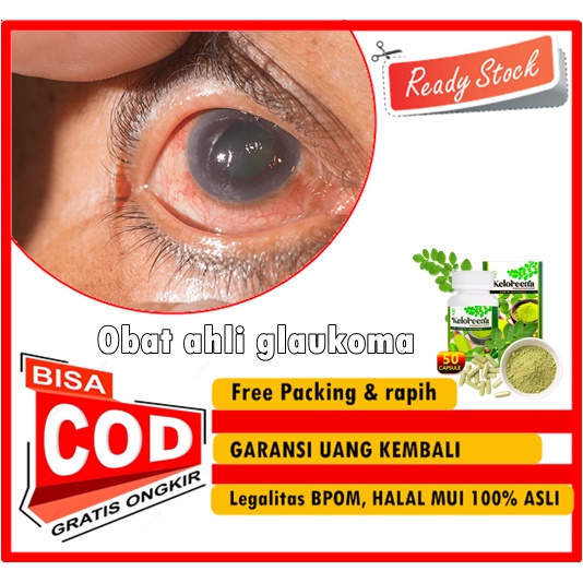 KELOREENA 100% - Obat ahli glaukoma - Obat glaukoma Herbal - Memperbaiki Mata Glaukoma