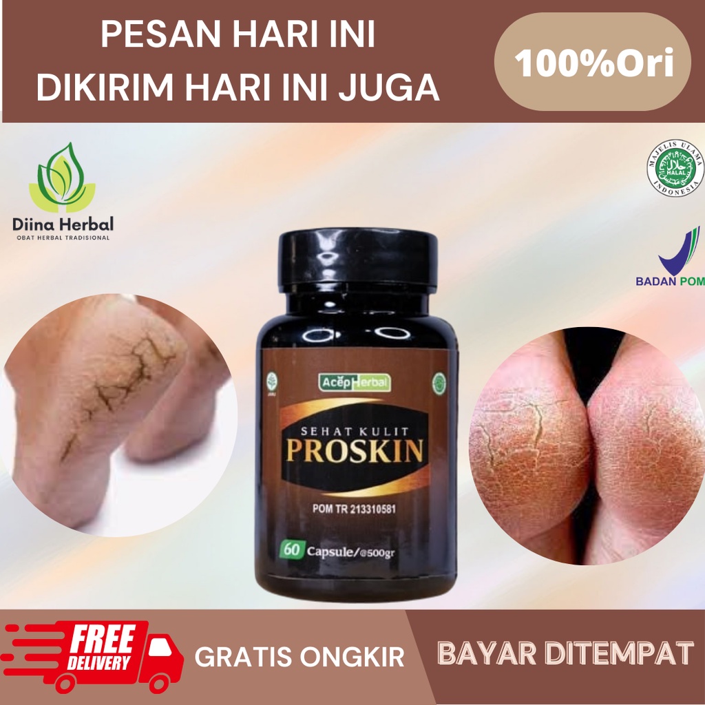 Obat Telapak Kaki Pecah Dan Kering, Obat Telapak Kaki Kasar Mengelupas, Obat Rorombeheun Kaki, Obat 