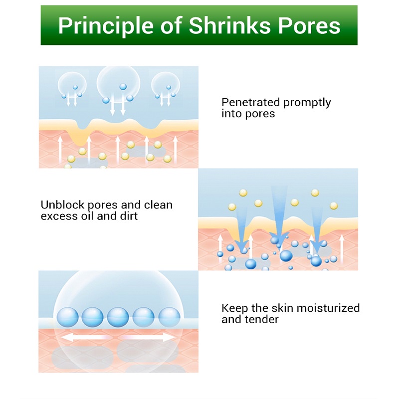 【CAN COD】Salicylic Acid Pores Refining Cream Shrink Pore Improve Acnes Whitening Cream Anti-Aging Oil Control Skin Care Mencerahkan Pori-pori Memurnikan Perawatan Kulit Kontrol Minyak Jerawat