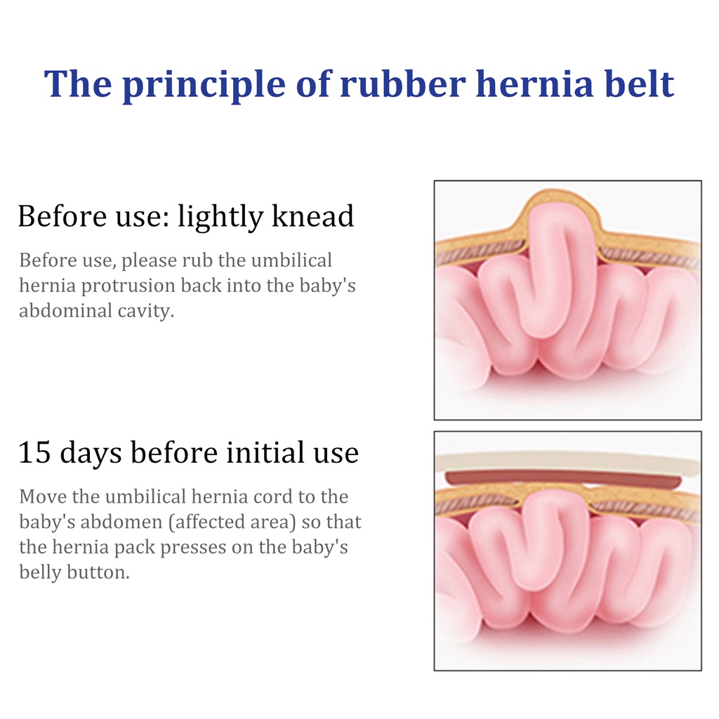 Sabuk Hernia Bayi Bodong Baby Umbilical Truss Belt Sabuk Pusar Bodong