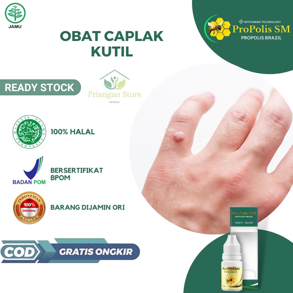 Obat Caplak Kutil, Obat Oles Penghilang Kutil, Obat Kutil di Jari Tangan, Obat Caplak Kutil di Jari 
