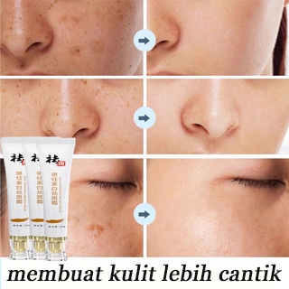 krim Serum cream Flek Hitam Cream Penghilang Cream flek Penghilang 50g Pemutih Asli Dan Penghilang Bintik Memudarkan Bintik Menghilangkan flek Cream penghilang