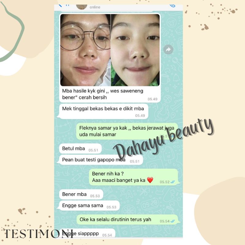 CREAM MALAM FLEK WHITENING EXPRESS