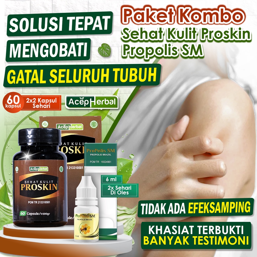 Jual Obat Gatal Seluruh Badan Berair Gatel Ruam Payudara Iritasi