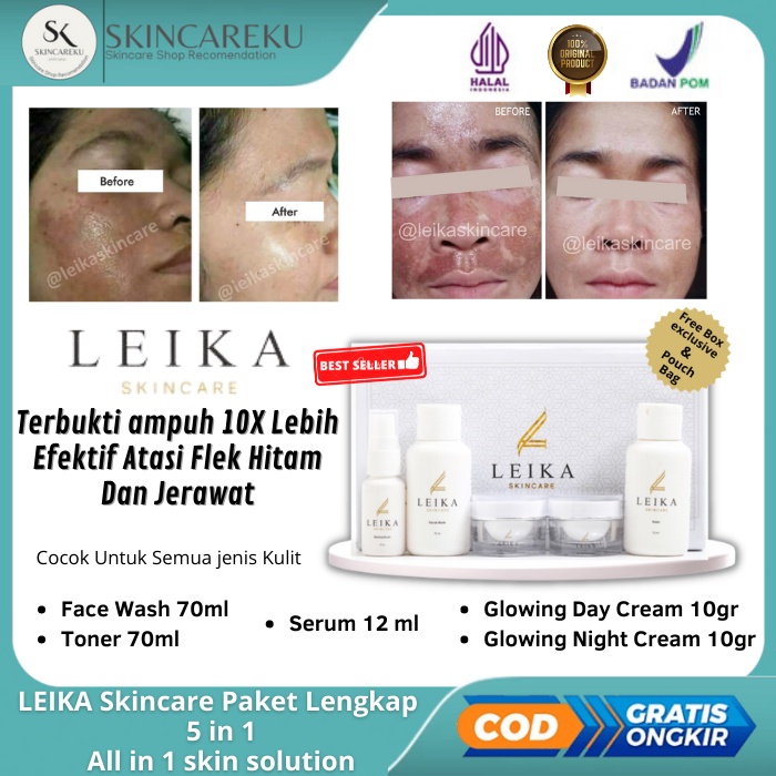 Paket Penghilang Flek hitam Dan Bekas Jerawat leika Skincare ORIGINAL BPOM