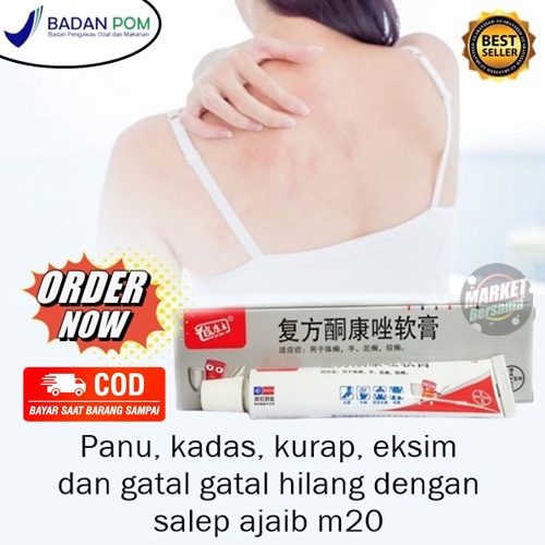 SALEP M20 Mujarab Salep Untuk Gatal Alergi Jamur Iritasi Kulit Eksim Ampuh ORIGINAL