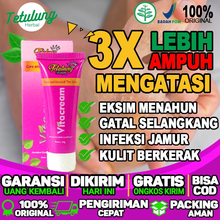 Salep Gatal Di Jari Tangan Salep Gatal Kulit Kering Salep Gatal Karena Alergi Dan Infeksi Jamur