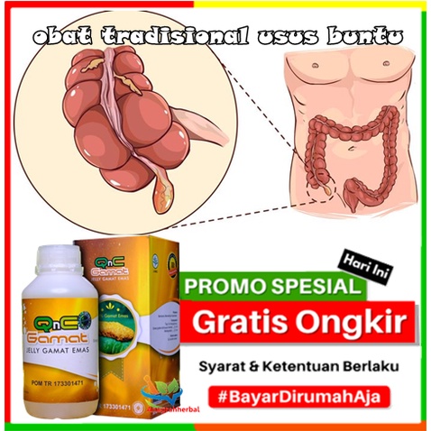 Obat tradisional usus buntu, Obat Penghilang Radang usus, Obat Alami Usus Buntu, Obat Tradisional Us