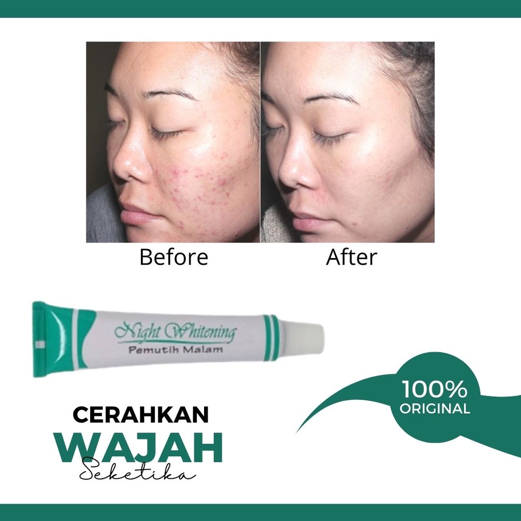 Salap Flek Hitam Night Whitening Original Salep Cream Penghilang Flek Hitam Membandel Di Wajah Ampuh