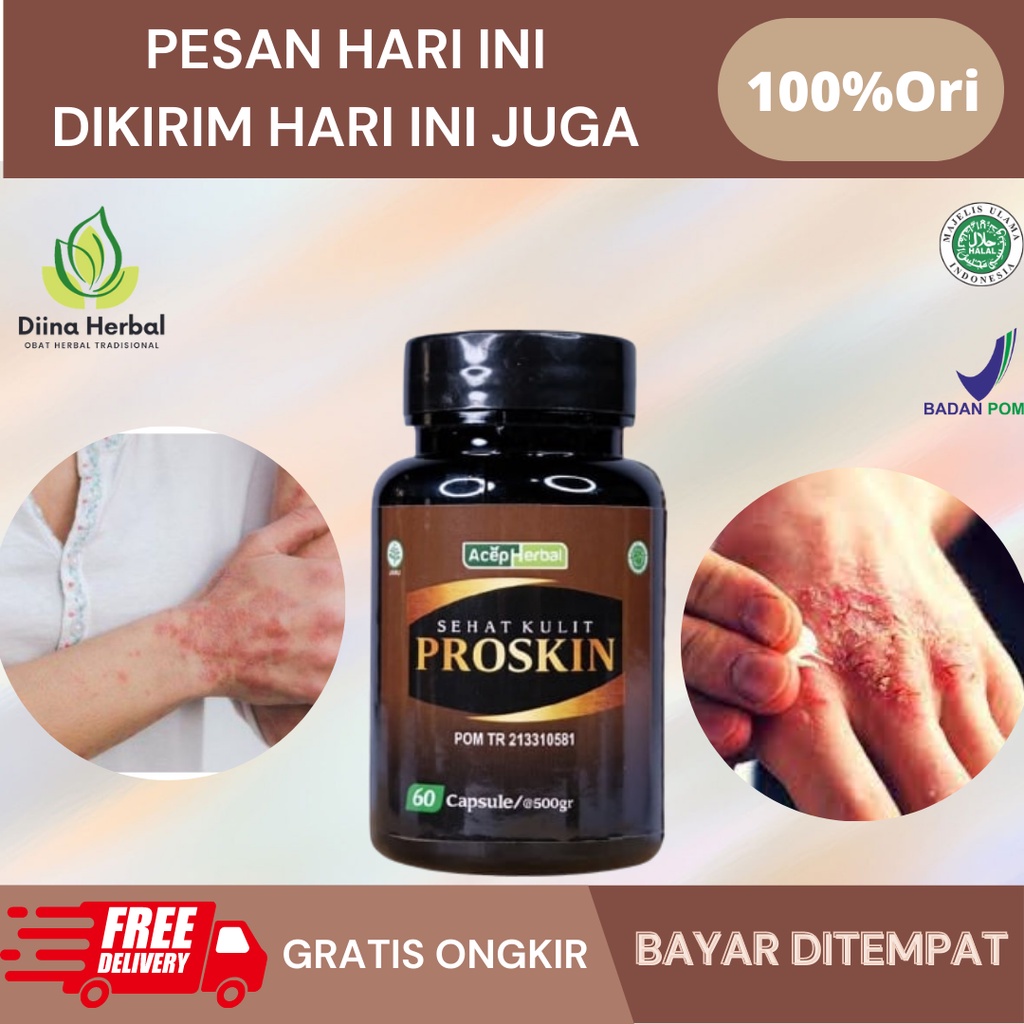 Obat Kudis Scabies Manusia, Obat Gatal Scabies, Obat Budug Kudis, Obat Scabies Menahun, Obat Pembasm