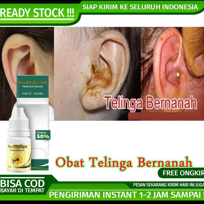 

TERLARIS Obat Congek - Obat Curek - Obat Telinga Bernanah - Obat Telinga Berair /OBAT TELINGA BERDENGUNG/OBAT TELINGA BERAIR/OBAT TELINGA TERSUMBAT/OBAT TELINGA BUDEG/OBAT TELINGA BERNANAH