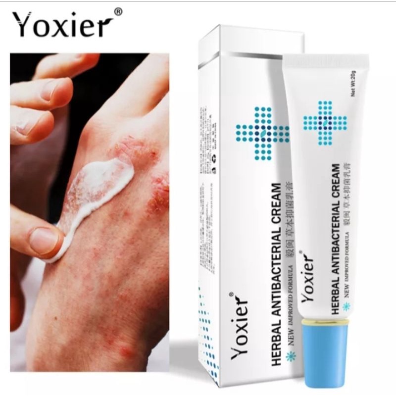 FS_SHOOP Yoxier Krim Psoriasis Alami 20G, Krim Perawatan Kulit Antipruritik Alami