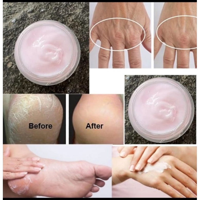 MAGIC HAND AND FOOT CREAM 20GR