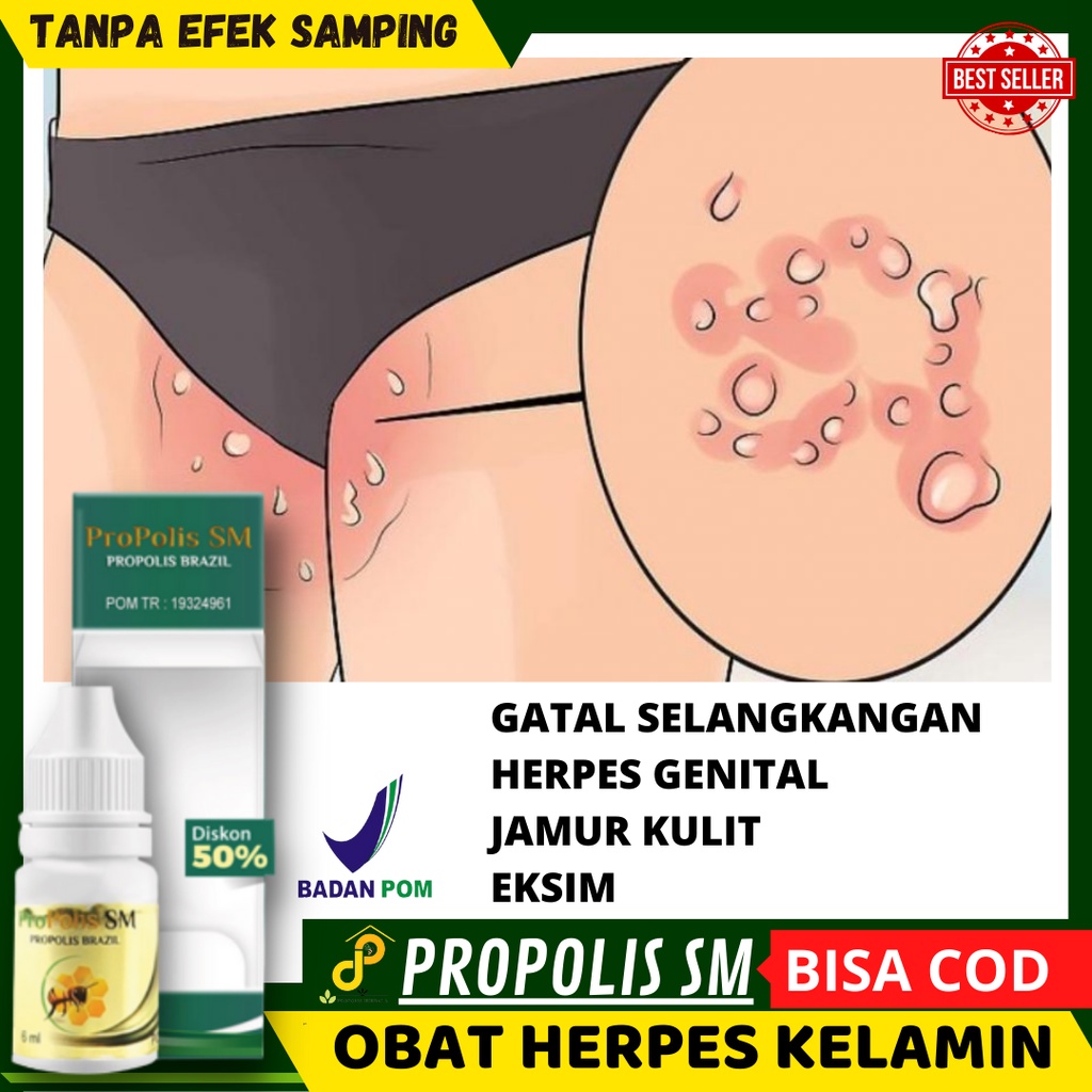 Obat Membersihkan Bintik-bintik merah yang berair dan perih di sekitar Selangkangan, Benjolan merah 