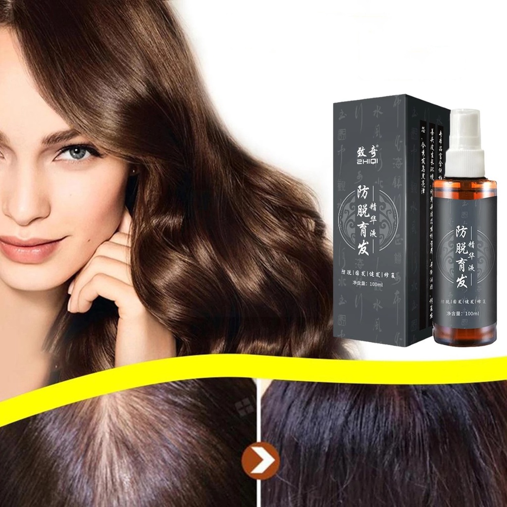 Minyak Penumbuh Rambut Botak Dan Rontok Essence Anti Rontok Mempercepat Pertumbuhan Rambut Pria Anak Bayi Balita -100ml