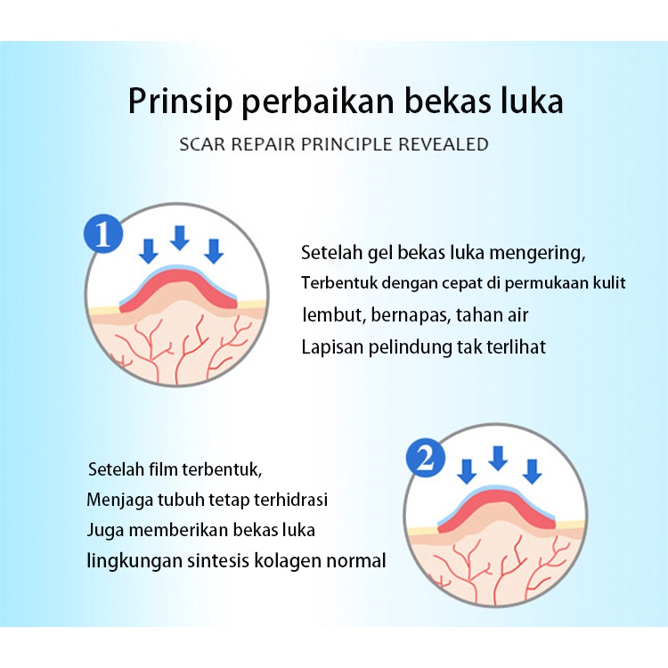 [100% AMPUH]  Gel penghilang bekas luka Operasi Memperbaiki bekas luka penghapusan bekas luka Meringankan bekas luka operasi Mencegah