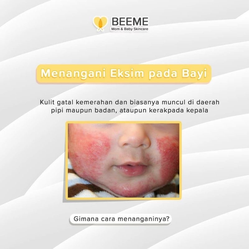 Beeme Nourishing Balm Skincare Bayi Newborn Ibu Hamil Pelembab Kulit Anti Ruam Bayi Alami Aman Tertelan