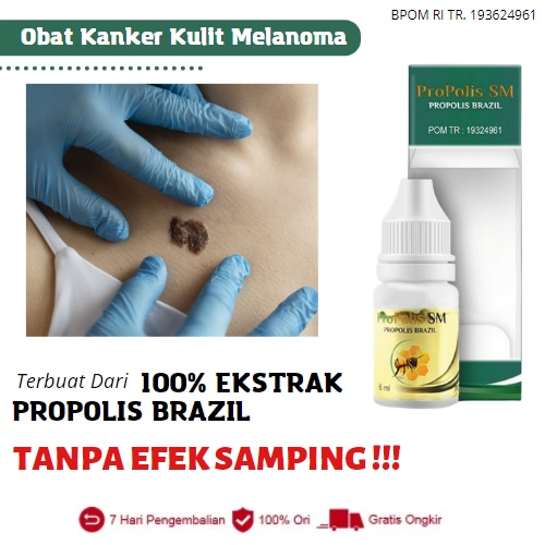 Obat Kanker Kulit Salep Kanker Kulit Melanoma Karsinoma Sel Basal Karsinoma Sel Skuamosa