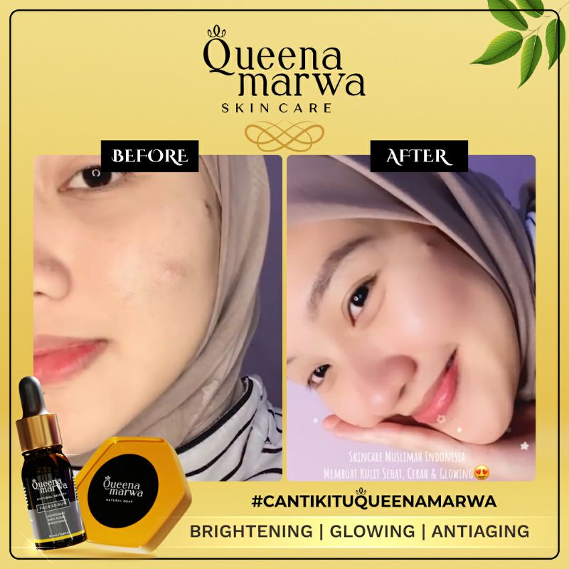 Queena Marwa Natural Soap Original Sabun Wajah Aman BPOM 80 gr