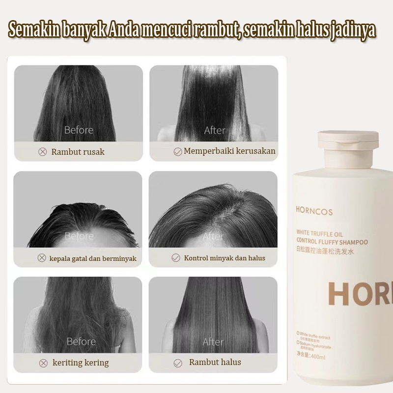 Sampo anti ketombe Sampo anti-rambut rontok Shampoo 400ML Kontrol minyak dan anti ketombe Mencegah rambut rontok Lembut dan tidak menjengkelkan Kontrol minyak yang menyegarkan