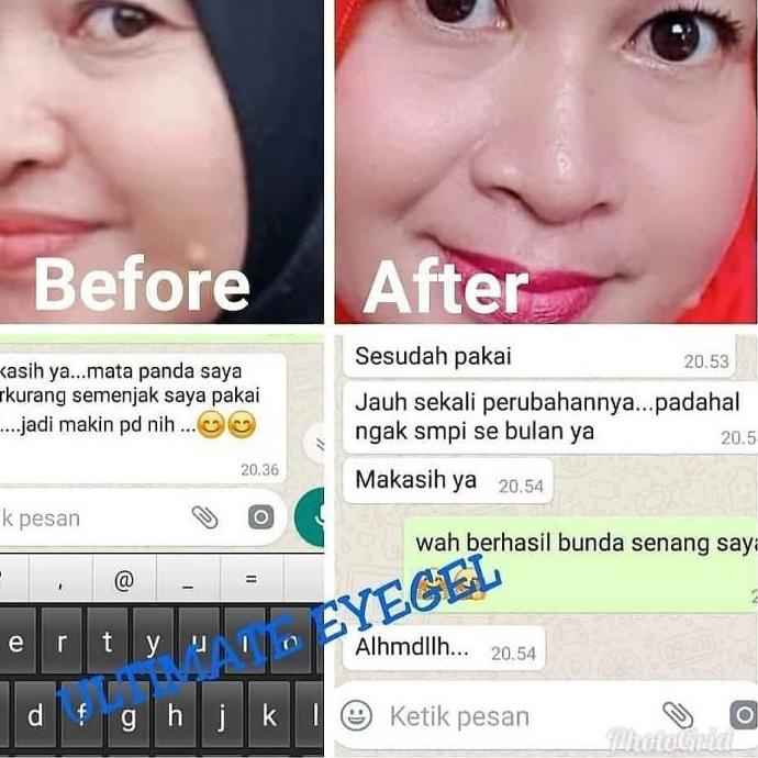 Berkualitas Nebi Ultimate Eye Gel, Cara Mudah Menyamarkan Kantung Mata, Mata Panda & Keriput Untuk W