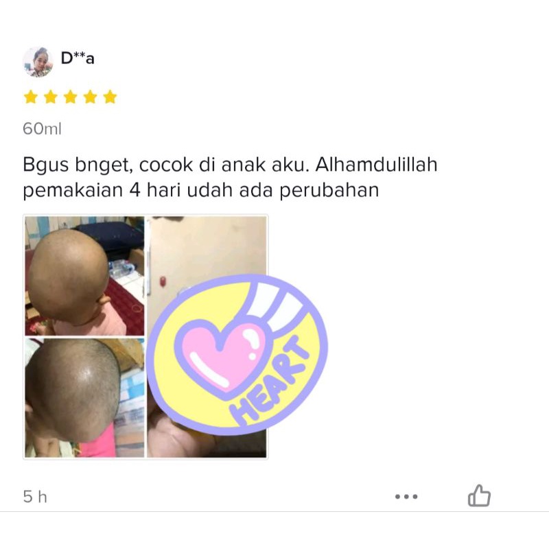 Minyak Kemiri Penyubur Rambut Pure
