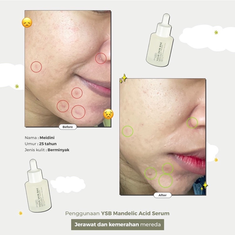 AVOSKIN Your Skin Bae Serum Mandelic Acid 5% + Panthenol + Perilla Extract (30ml)