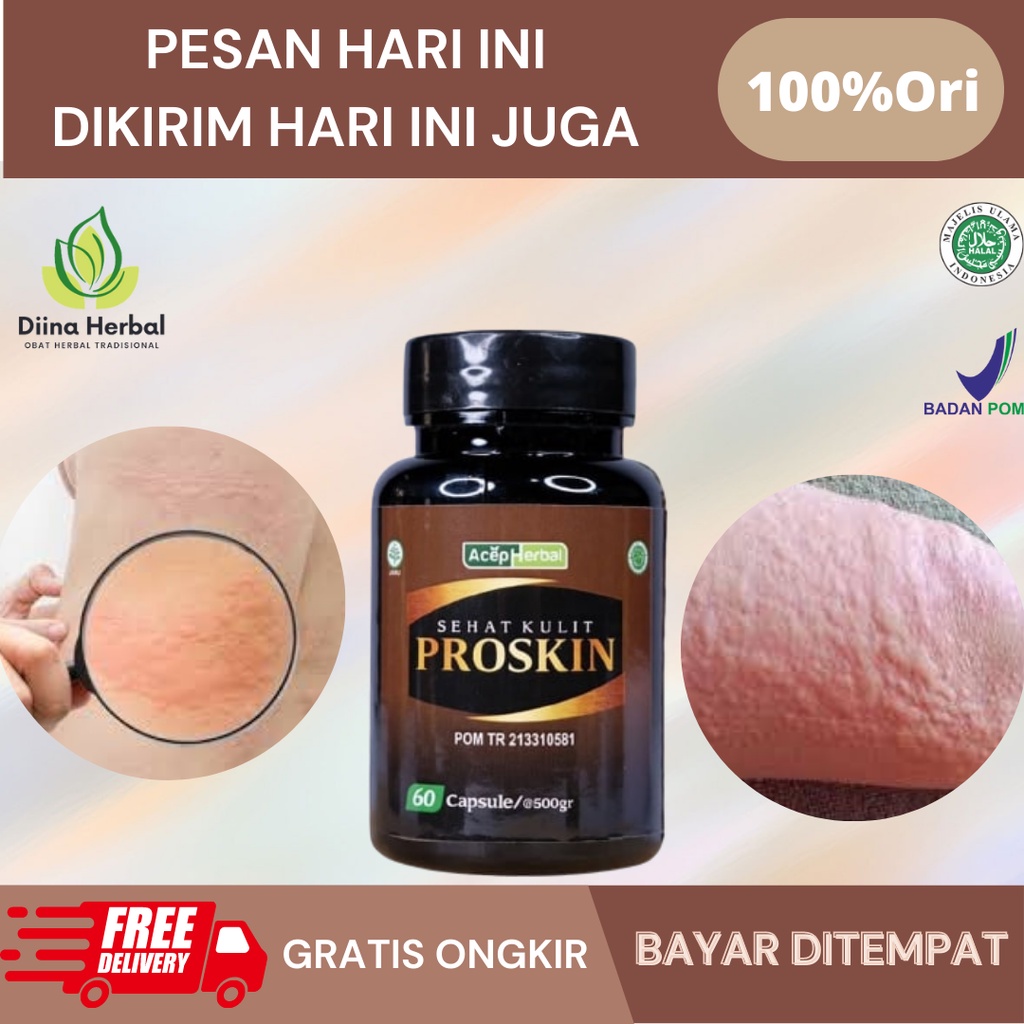 Obat Biduran Dan Gatal Gatal, Obat Alergi Kulit Gatal Bentol Biduran, Obat Gatal Biduran Kapsul, Oba