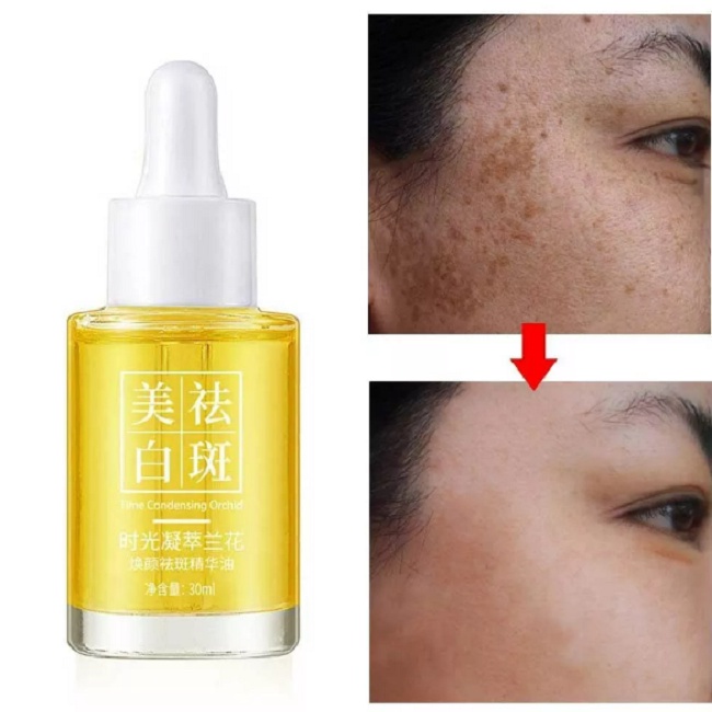 Minyak Anggrek 30Ml Korea Serum Pemutih Flek Hitam Esensial Anggrek Pelembap Wajah