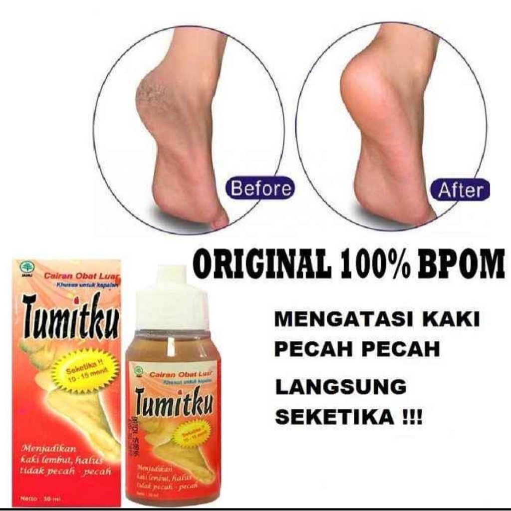 TUMITKU original Obat kaki pecah dan kering foot cream ampuh bpom original