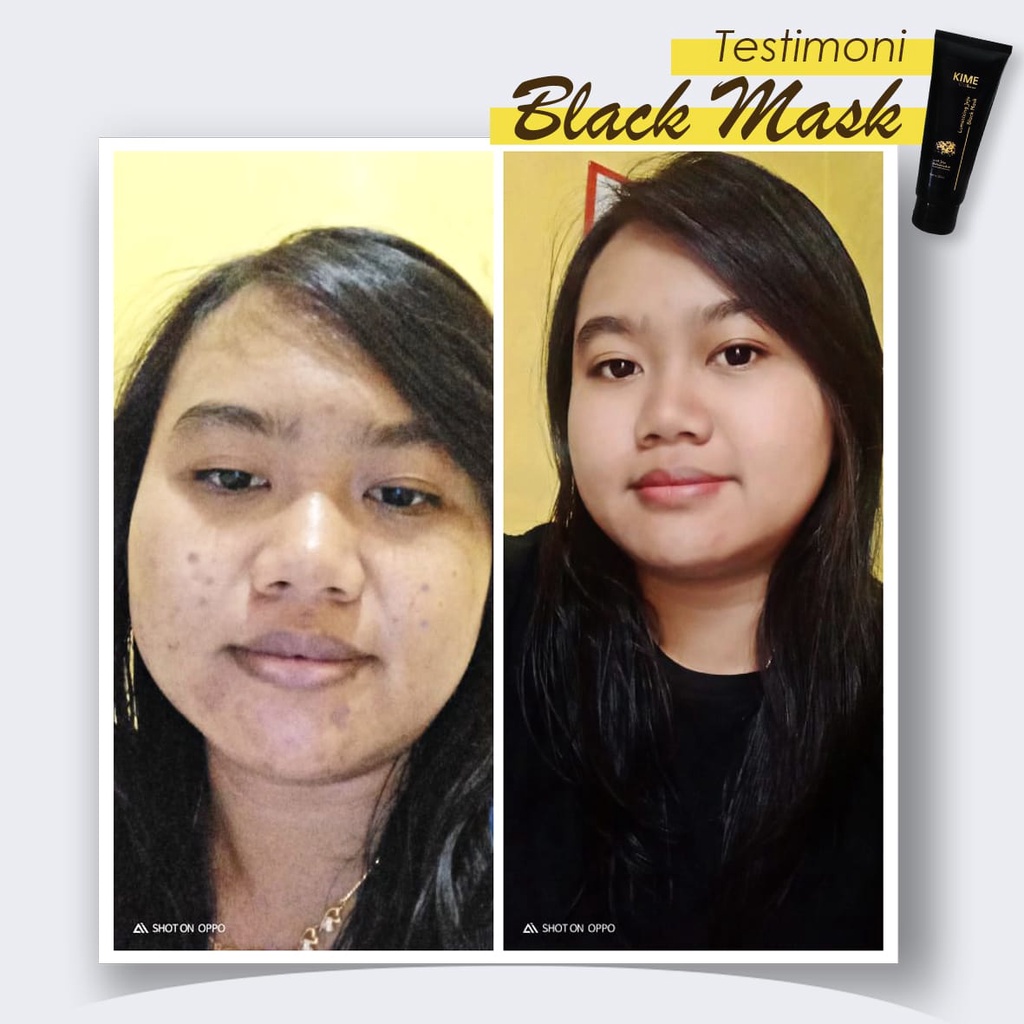 Promo Bundle Black Mask dan Brightening Soap Sabun Kime Skincare